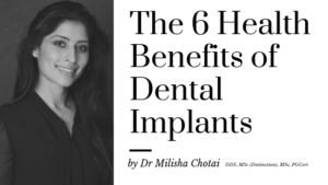 the health benefits of dental implants