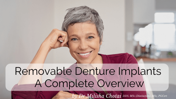 removable denture implants
