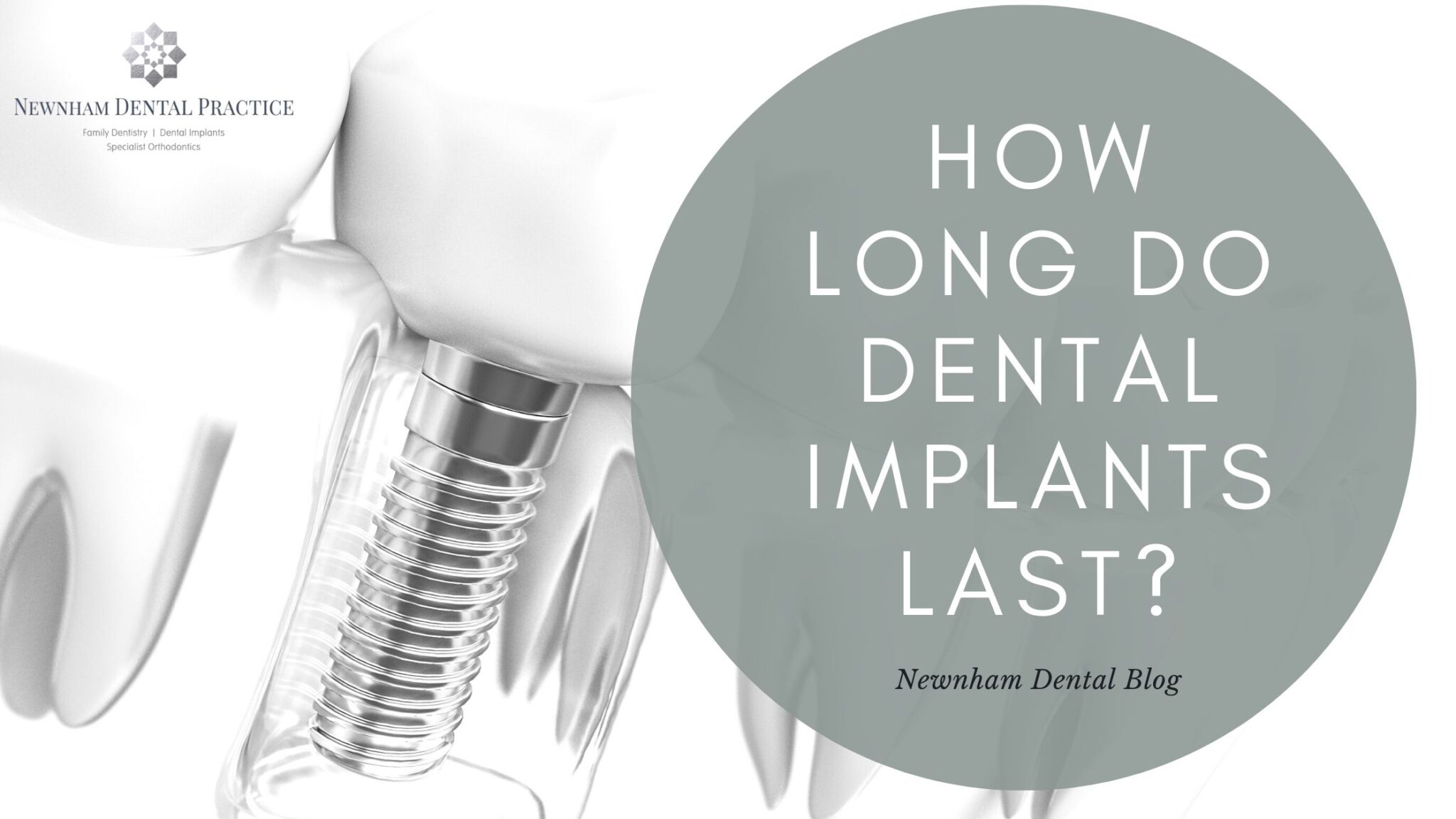 How Long Do Dental Implants Last Newnham Dental