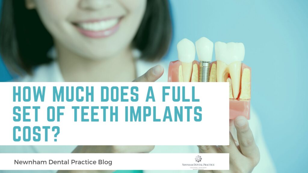 How Much Does a Full Set of Teeth Implants Cost_