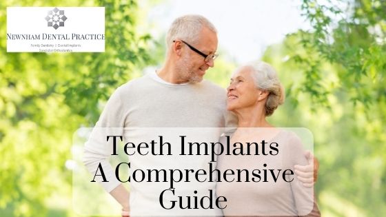 everything you need to know about teeth implants