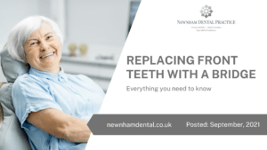 Replacing front teeth with a bridge