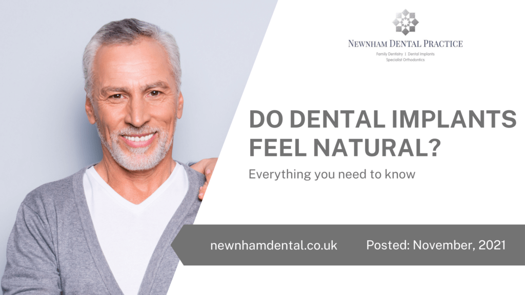 Do Dental Implants Feel Natural - Everything You Need To Know