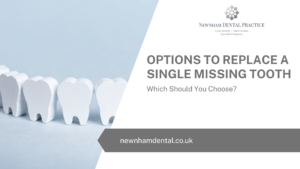 Options To Replace A Single Missing Tooth - Which Should You Choose?