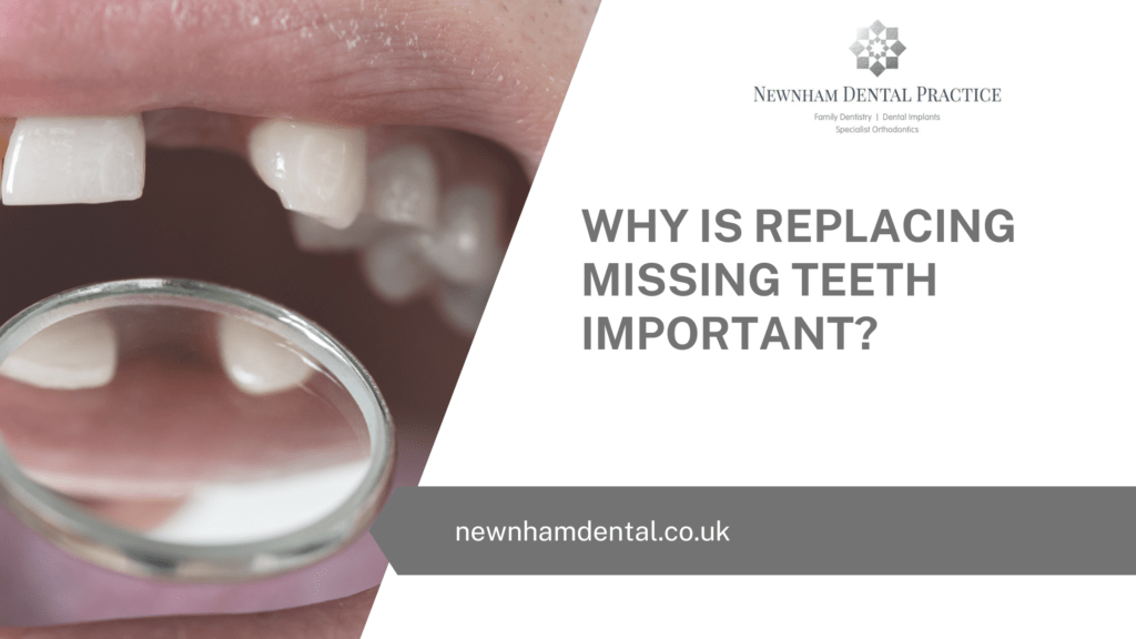 Why Is Replacing Missing Teeth Important?