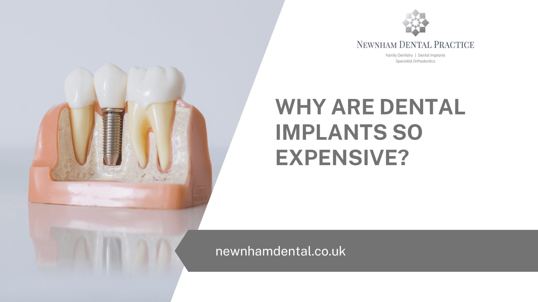Why Are Dental Implants So Expensive? Newnham Dental